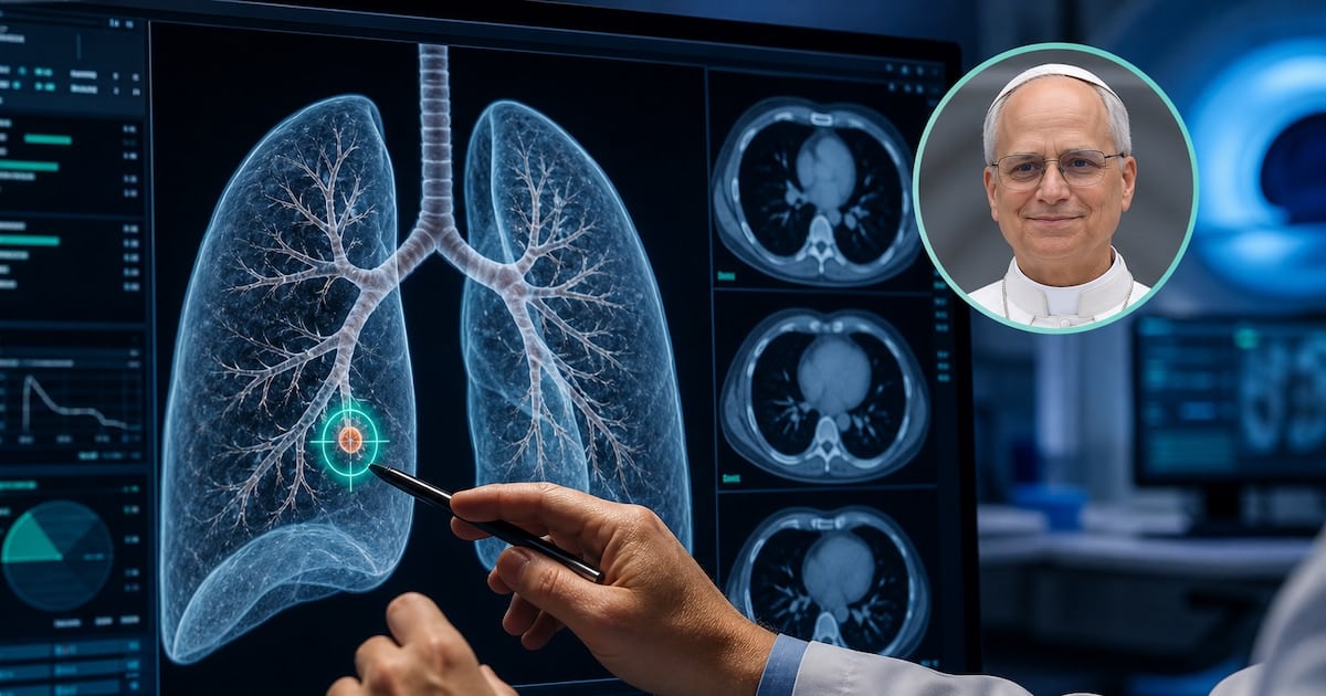 Un nódulo pulmonar diminuto y la decisión de operarlo: claves médicas detrás del caso León XIV